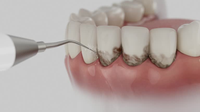 Reliable Dental Implants contractor in Chanhassen, MN by Smile Center Dentistry